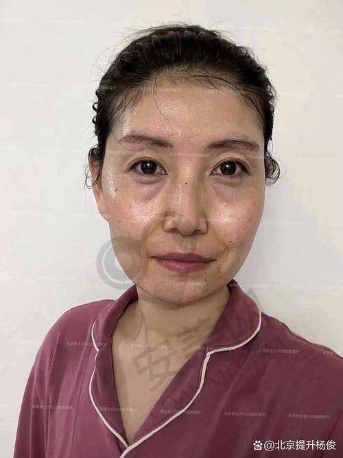 上海华美面部提升的医生团队实力怎样？