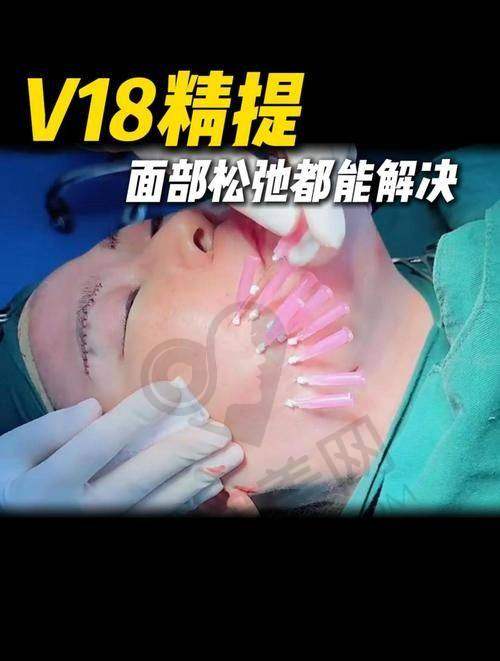大连星妍整形在加强版VLine提升型脸型精细化雕刻方面有哪些优势？
