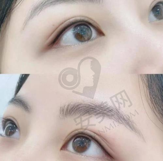 昆山玥美医疗美容的口碑和信誉如何？