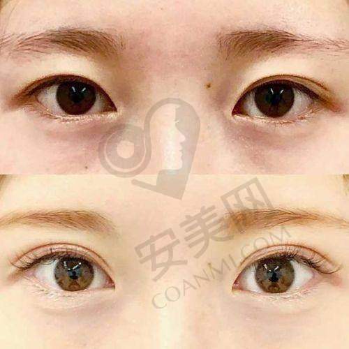 灵动桃花眼能给生活带来哪些改变？