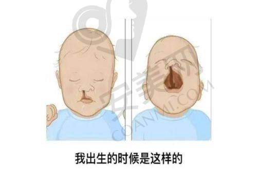 广州高尚唇裂修复的服务质量好不好？