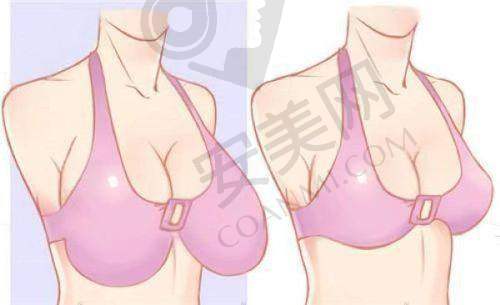 术后修复：见证神奇的改变