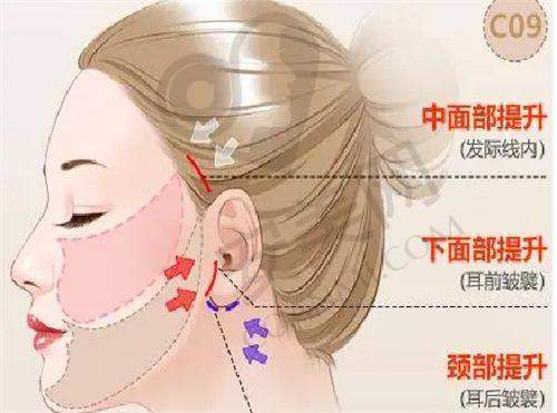 整形项目价格表：了解整形费用的参考