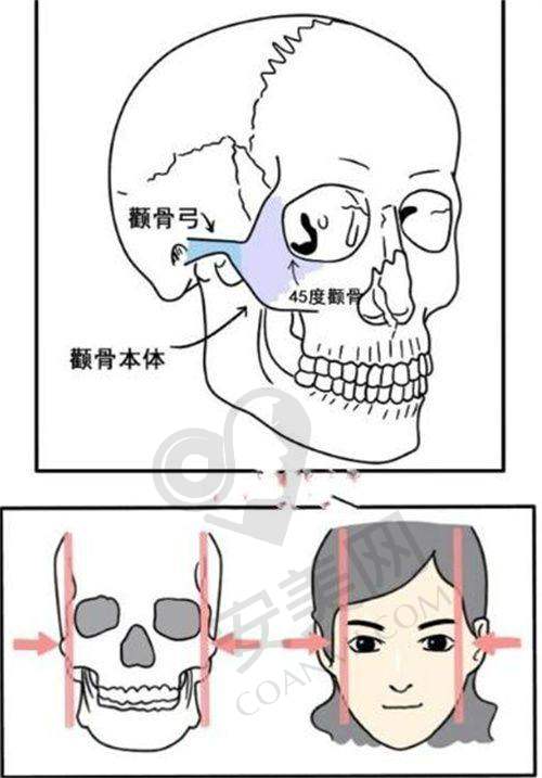 2、珠海如花霍旺佳医生擅长项目：