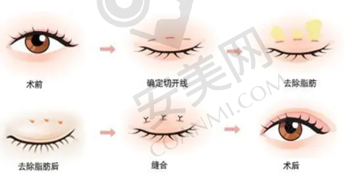 到院路线选择建议
