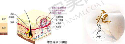 3、南京康美陈小剑医生整形技术怎么样？