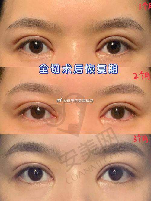 哈尔滨艺星打造灵动桃花眼的技术优势有哪些？