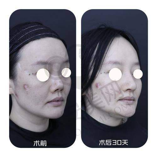 南京康美医院鼻综合整形与其他医院相比有什么独特之处？