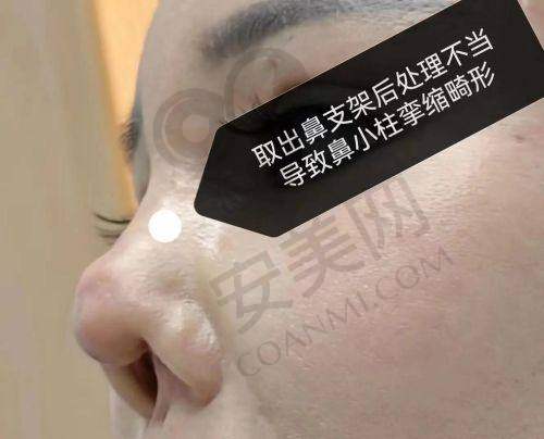 长沙艺脂李瑶医生的资质如何？
