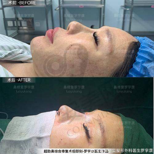 南京康美医院鼻综合整形的技术优势有哪些？