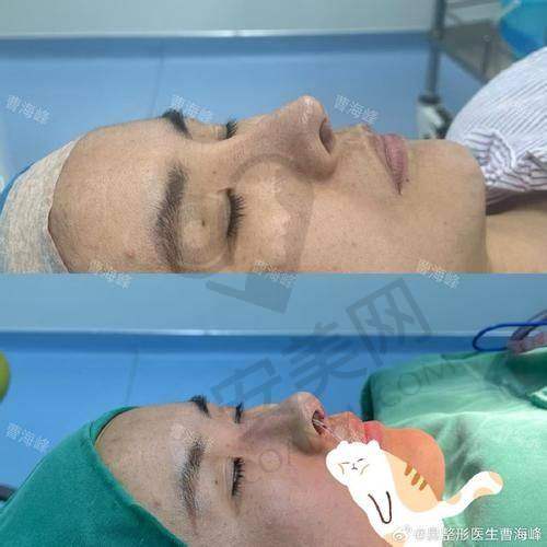 5、长沙艺脂李瑶医生患者评价