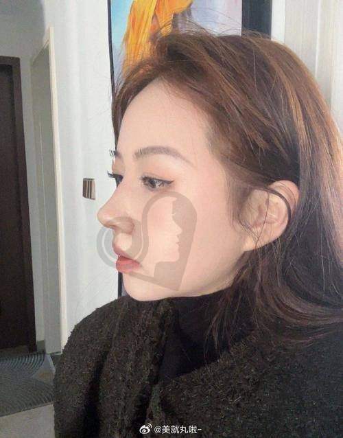 长沙艺脂医院的环境和服务对手术有影响吗？