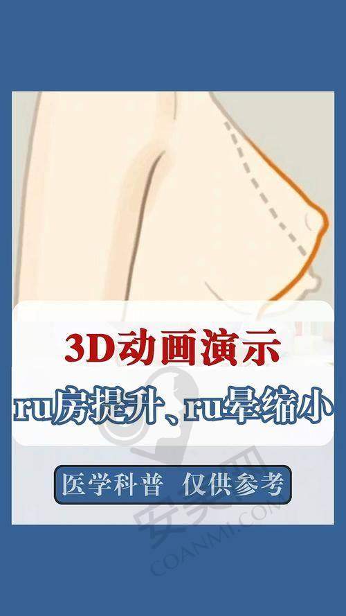 结语：拥抱美丽，告别尴尬
