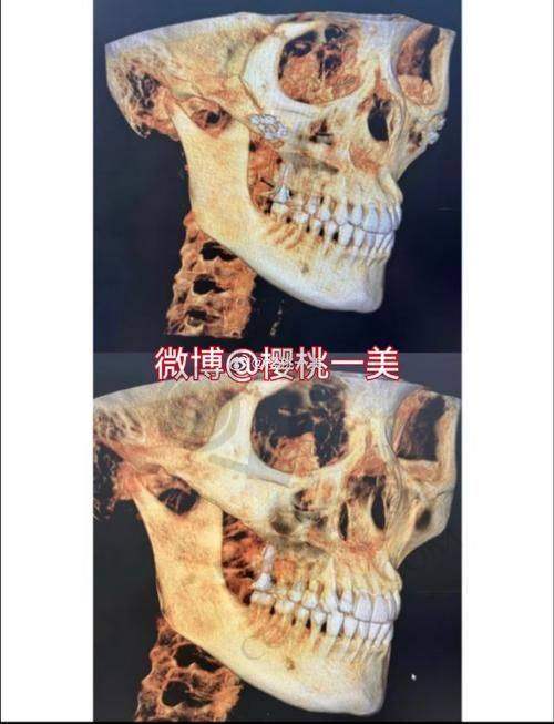 结语