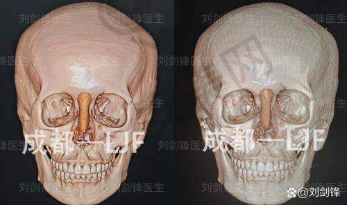 成都东篱医院优势
