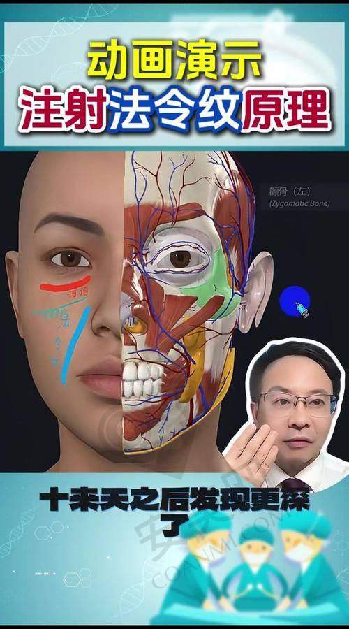 玻尿酸注射去法令纹有风险吗？