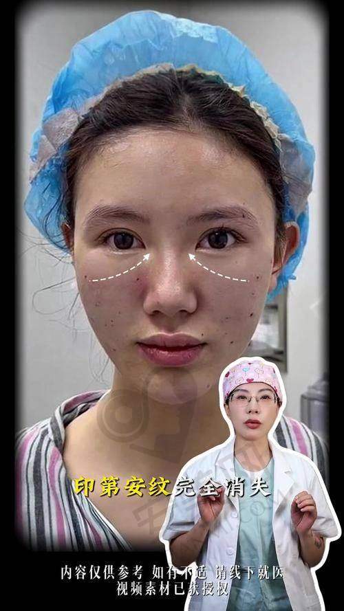 总结