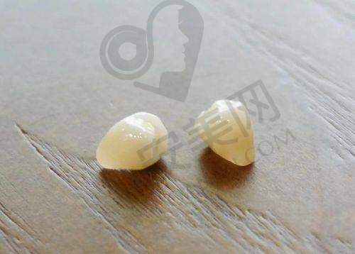 南宁牙博士口腔安装爱尔创全瓷牙冠的流程是怎样的？