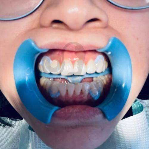 就诊前的检查是怎样进行的？