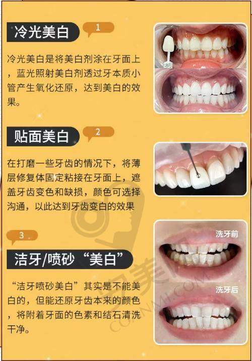 汕头牙博士口腔牙齿美白值得推荐吗？
