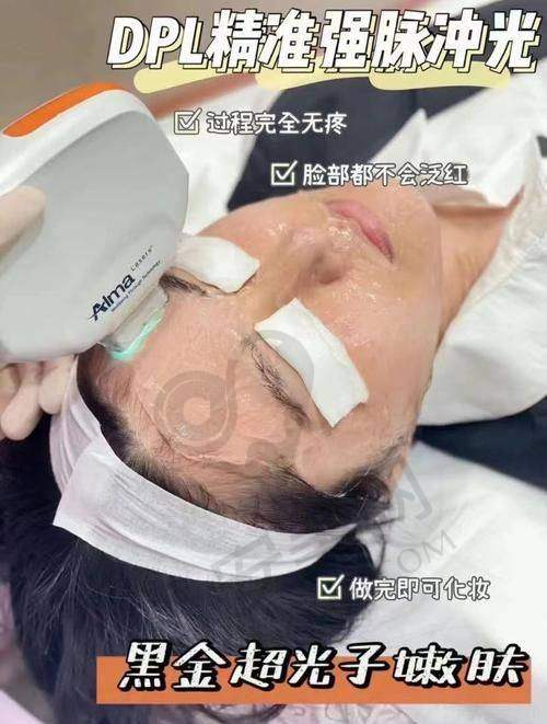 广州华美AOPT超光子治疗后成效如何？