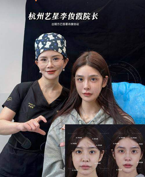 西安画美医生注射玻尿酸的优势有哪些？