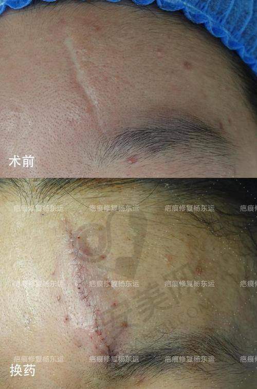 非国有医院的成都友谊医院疤痕科有哪些优势？
