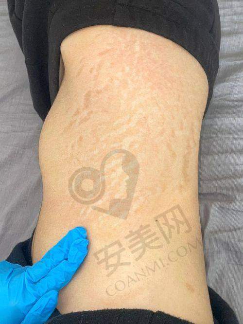 合肥韩美医院的服务怎么样？