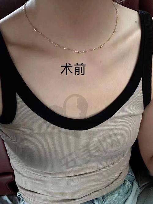 手术前的准备工作有哪些？