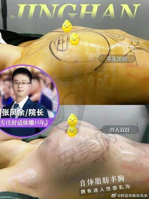 手术过程是怎样的体验？