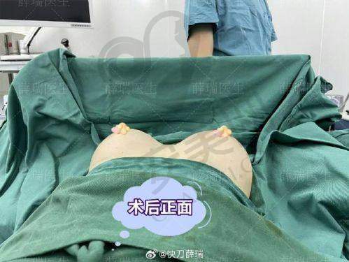 珠海韩妃医院假体隆胸技术有何独特之处？