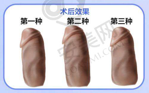 选择殷初阳医生的优势总结
