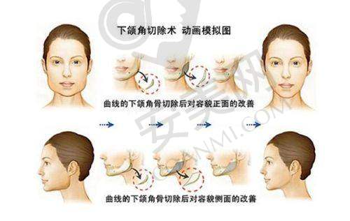 保定珍润医疗美容门诊部患者评价：