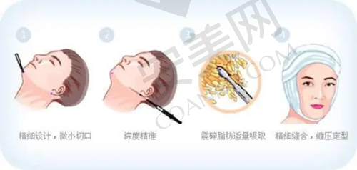 合肥维多利亚整形医院的口碑如何？