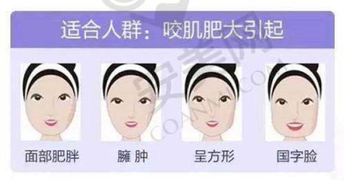 多维动态直腿术的价格是如何确定的？