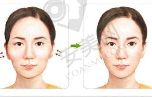 鼻部整形医生有哪些拿手绝技？