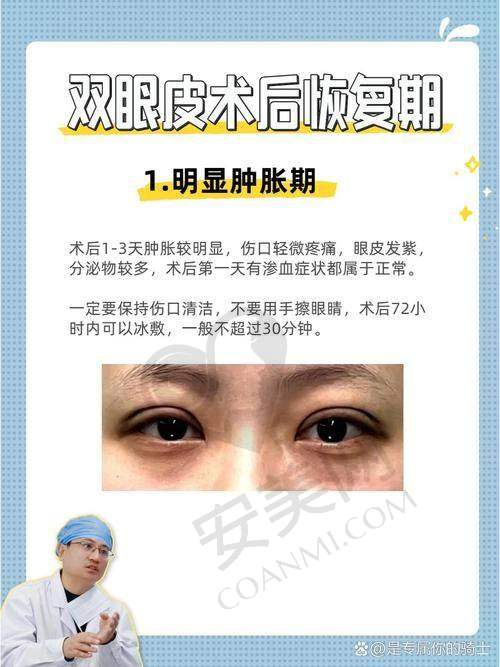 深圳艺星不同套餐的全切去皮去脂肪价格是怎样的？