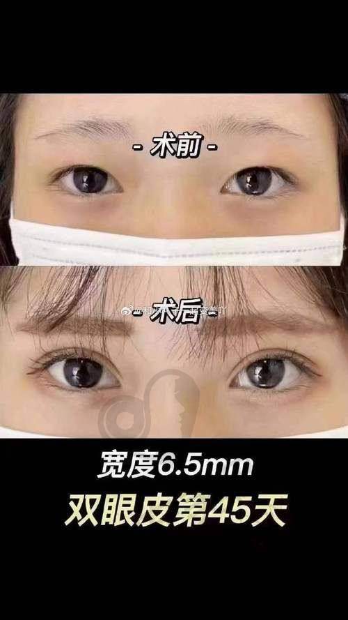 手术过程：专精技术带来的安心体验