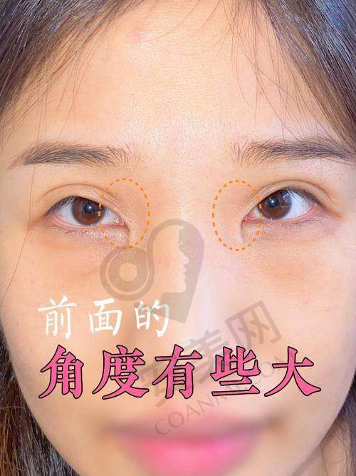 选择刘志刚院长，开启美丽新征程