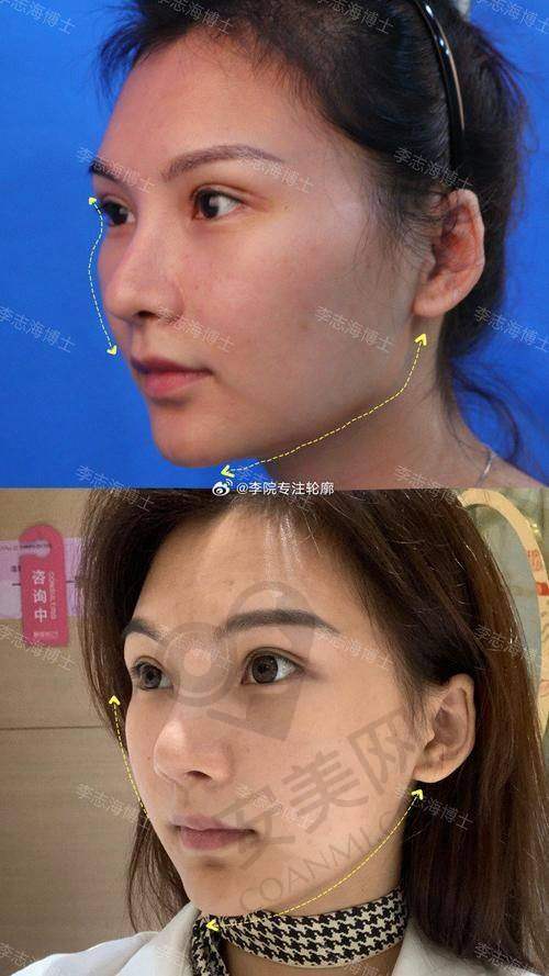 总结