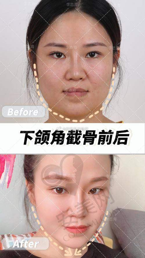 昆明娇点整形美容医院