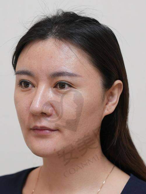 与患者的沟通和个性化方案制定