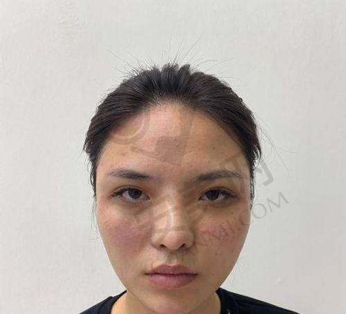 卜双燕医生的审美理念与优势