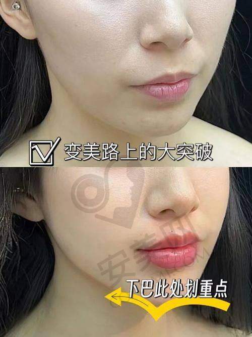 选择适合自己的医院：综合考量多方面因素