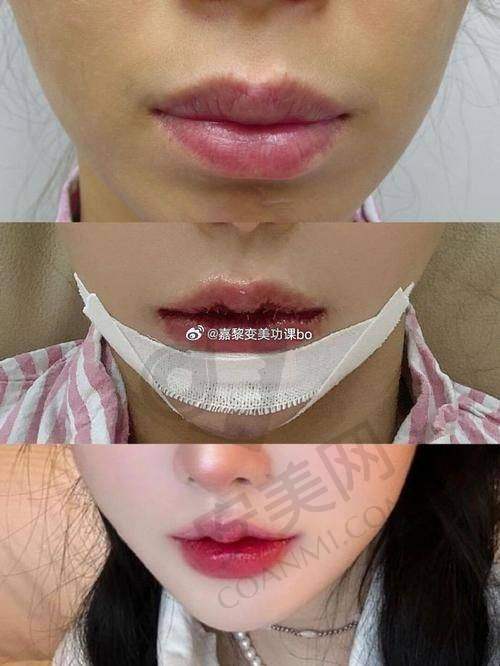 重庆华美整形：人气与实力并存