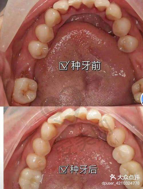 烟台白玉口腔于爱荣医生擅长项目