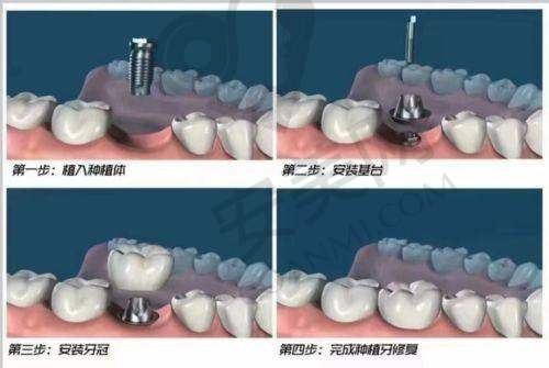 吉林德立联合口腔王振海医生怎么样？