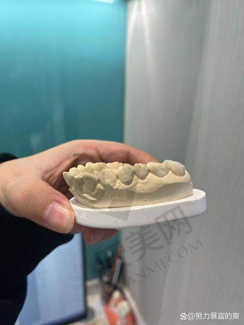 海口国雅口腔医院半口种植牙价格为何如此实惠？