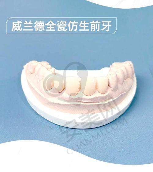 什么是深圳新安麦芽口腔臻至美全瓷牙？