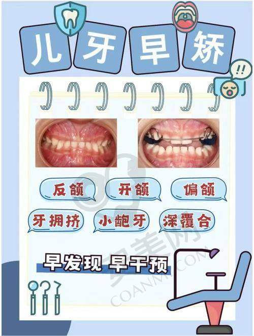 什么是儿童早期干预矫正？